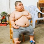 Bahaya Obesitas pada Anak : Dampaknya terhadap Kesehatan